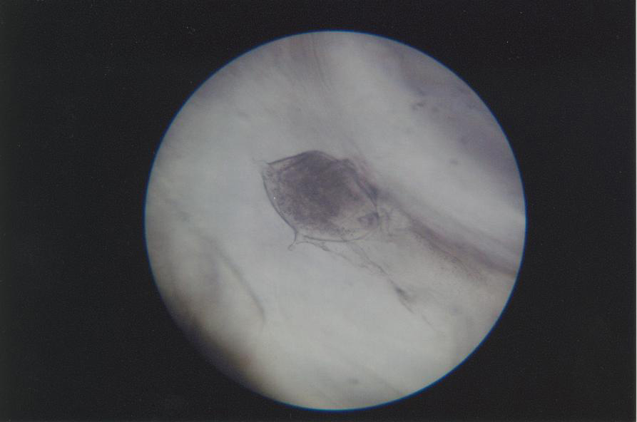 Метацеркария р. Diplostomum в хрусталике глаза карася (ориг. фото)